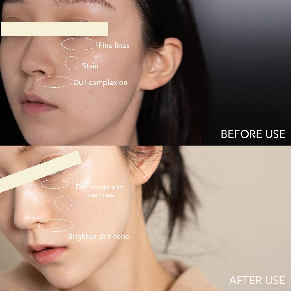 AILKE Dark Spot Corrector Cream With SPF 35 Korean Whitening Hydration