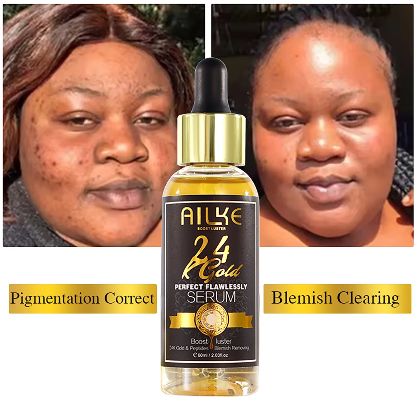 AILKE 24k Gold Flawlessly Whitening Skin Care Set For All Skin Type, Moisturizer, Reduce Black Spots, Smoothing, Brightening